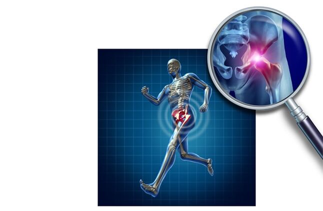 Bolečina pri teku v kolčnem sklepu